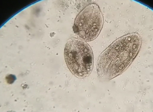 Mikroskobik Canlılar ~ videonun sonunda canlılar ölüyor